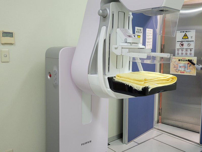 マンモグラフィ